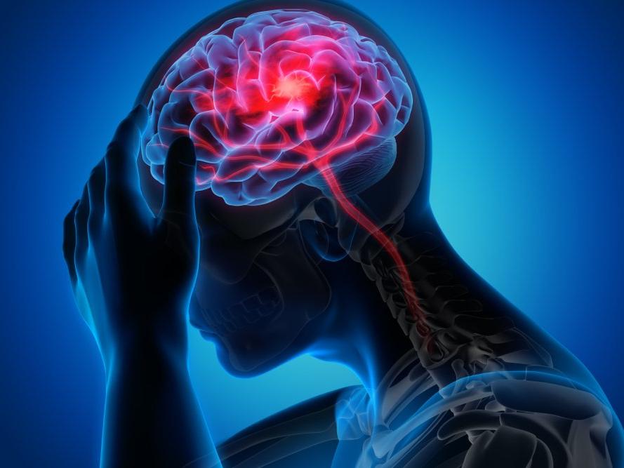 ABD'li uzmanlardan beyin hasarlarını tedavi edecek sistem