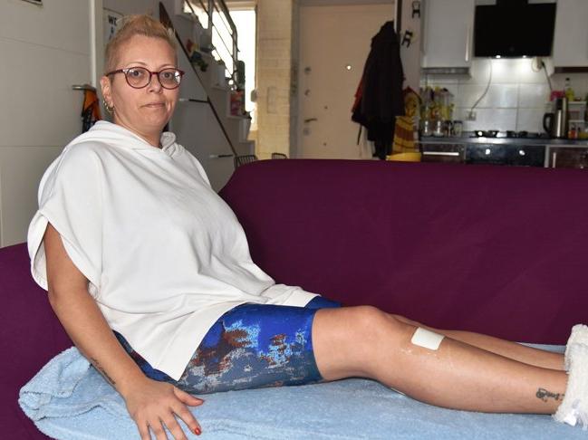 İşe giderken sokak köpeğinin saldırısında yaralandı