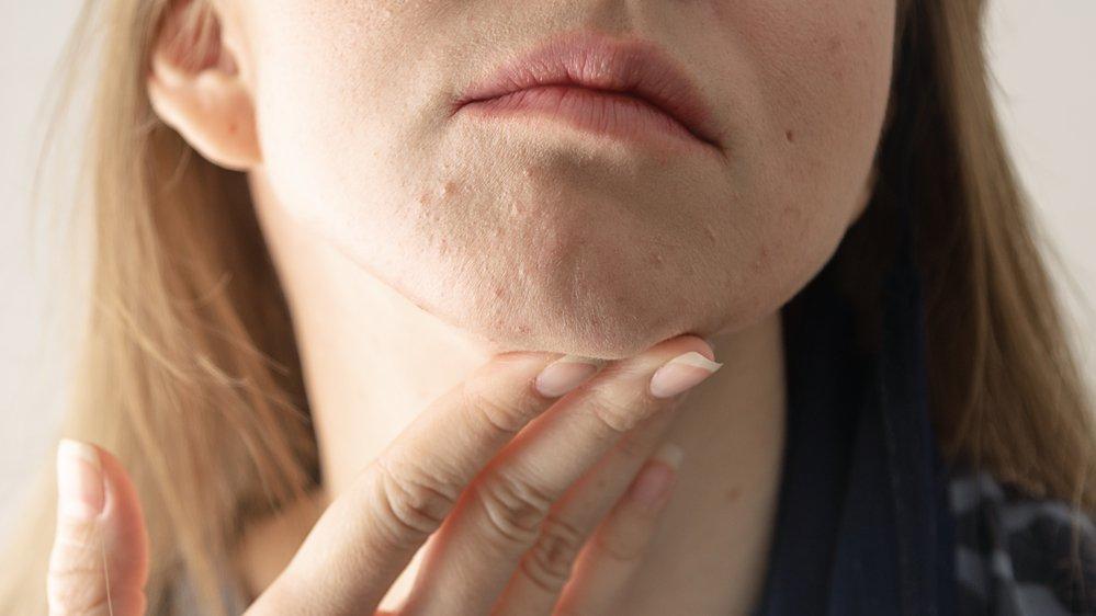 Uzmanlar uyardı: İyi hissediyorsanız ama cildinizde bu belirtiler varsa Omicron olabilir