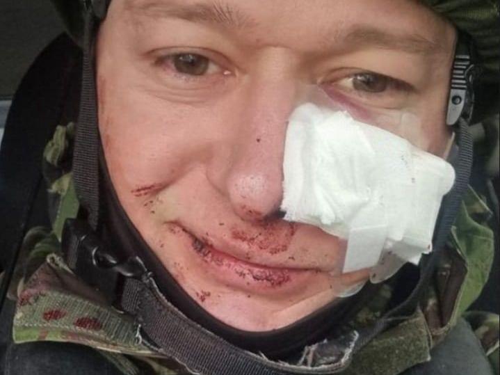 Orduya katılan Ukraynalı müzisyen, Rus saldırılarında yaralandı