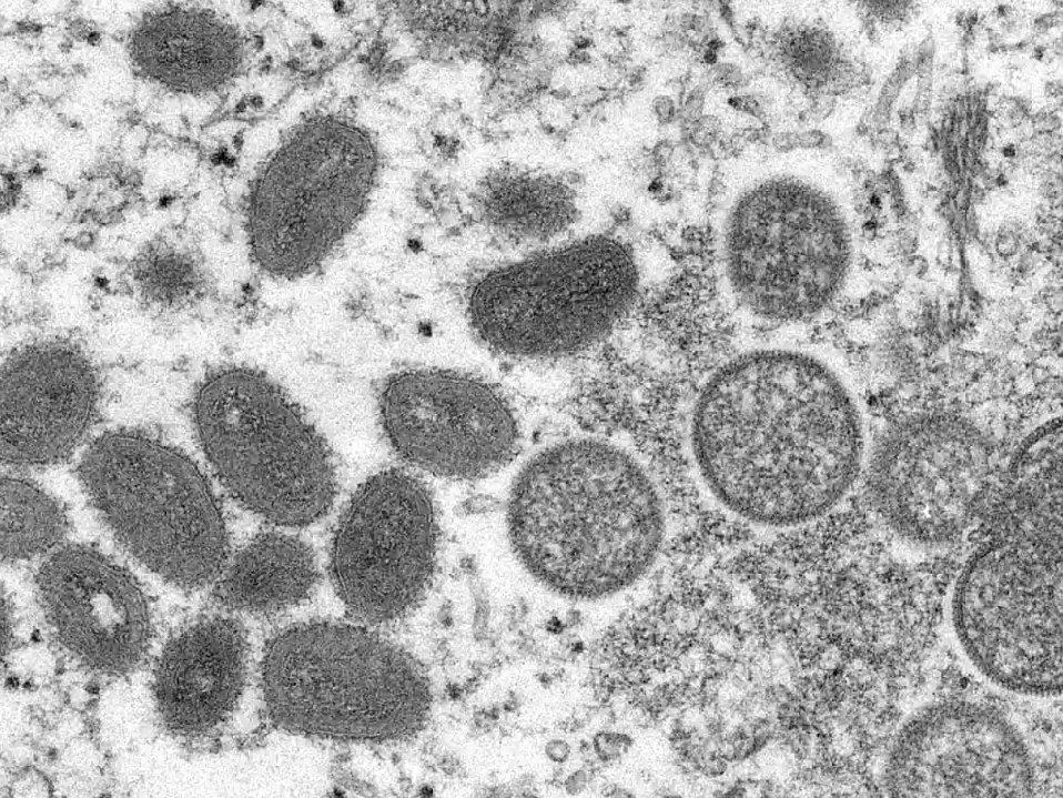 Avrupa'nın ardından ABD'de monkeypox (maymun çiçeği) virüsü alarmı