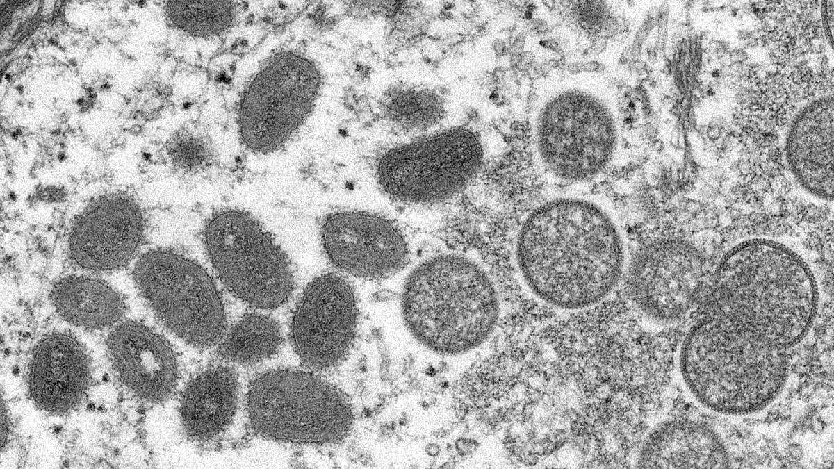 Maymun çiçeği virüsü (Monkeypox) hakkında bilmeniz gereken 8 şey: En çok kime bulaşıyor?