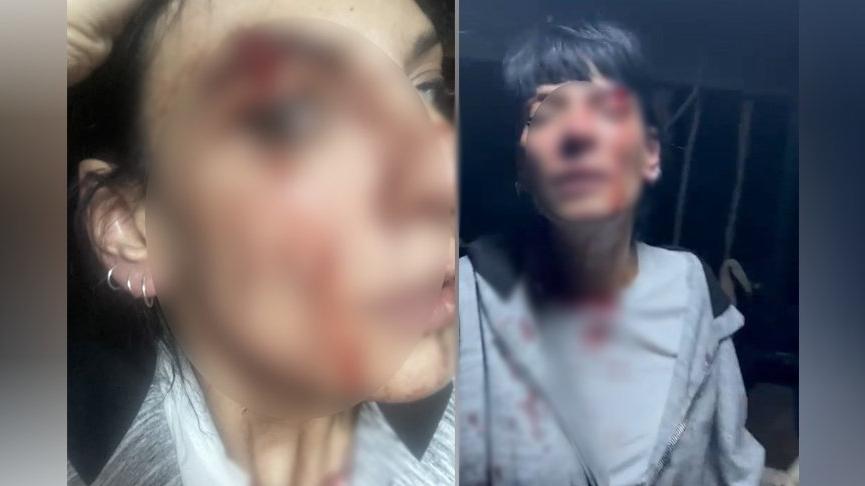 Esenyurt'ta kadına şiddet: 2 kişi tutuklandı