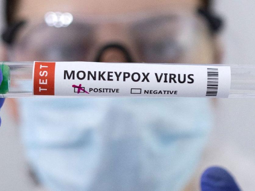 Maymun çiçeği virüsü İngiltere'de kontrol altına alınamıyor