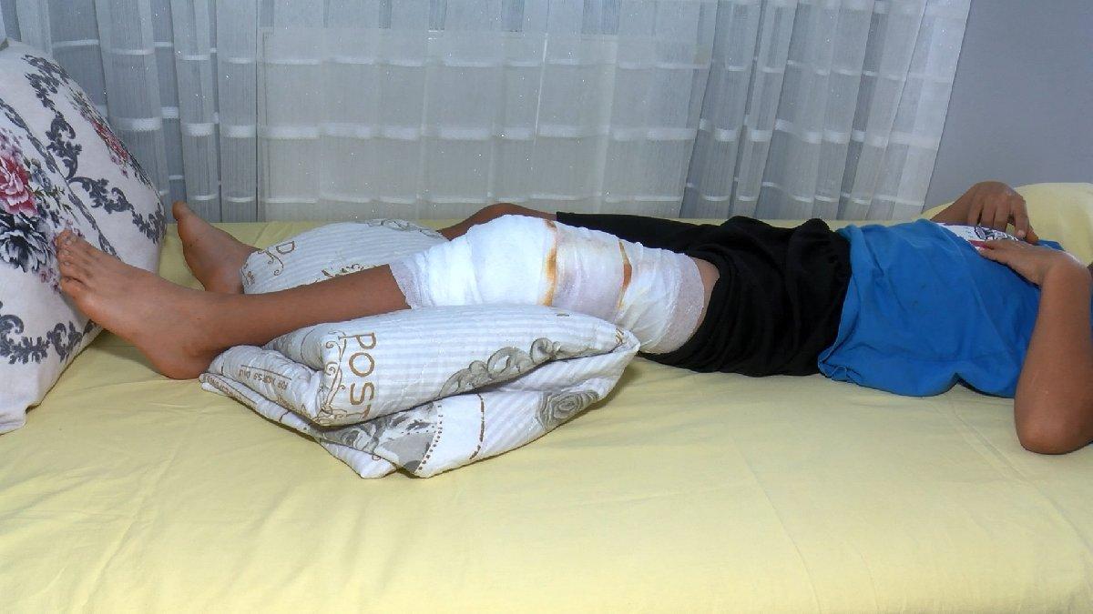 İstanbul'da parkta oynayan çocuğa pitbull saldırdı 