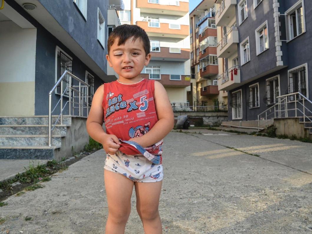 Kastamonu'da 3 yaşındaki Miraç sokak köpeklerinin saldırısına uğradı!