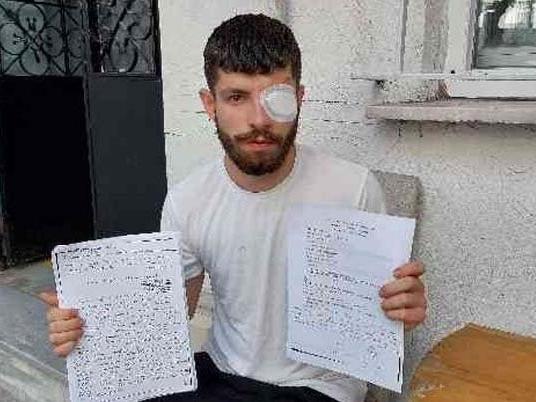 İşçiye bardak fırlatan muhasebeci tutuklandı