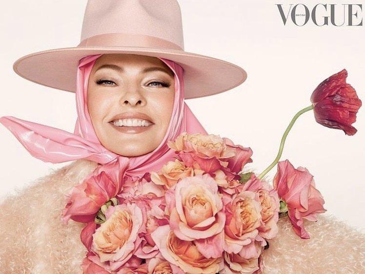 Yüzü deforme olan 57 yaşındaki süper model Linda Evangelista gerdirme bantlarına başvurdu