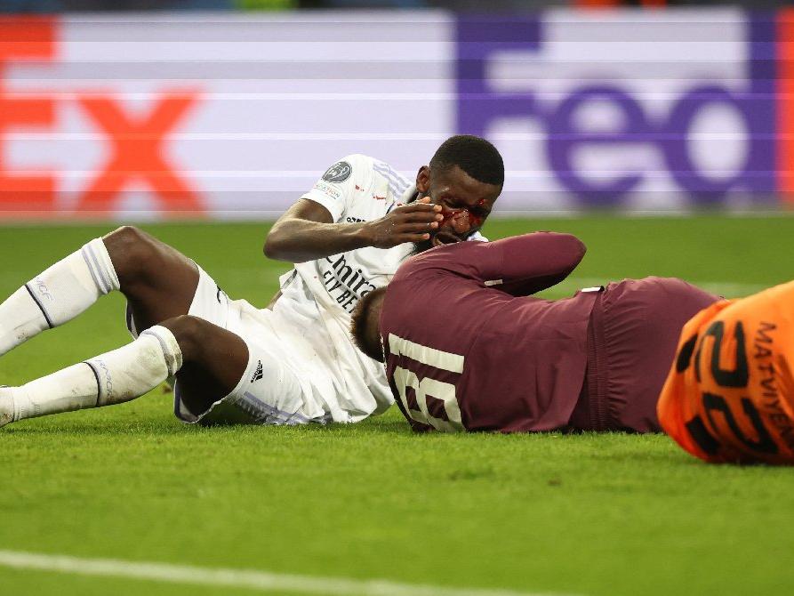 Real Madrid'in kahramanı Rudiger'e 20 dikiş atıldı
