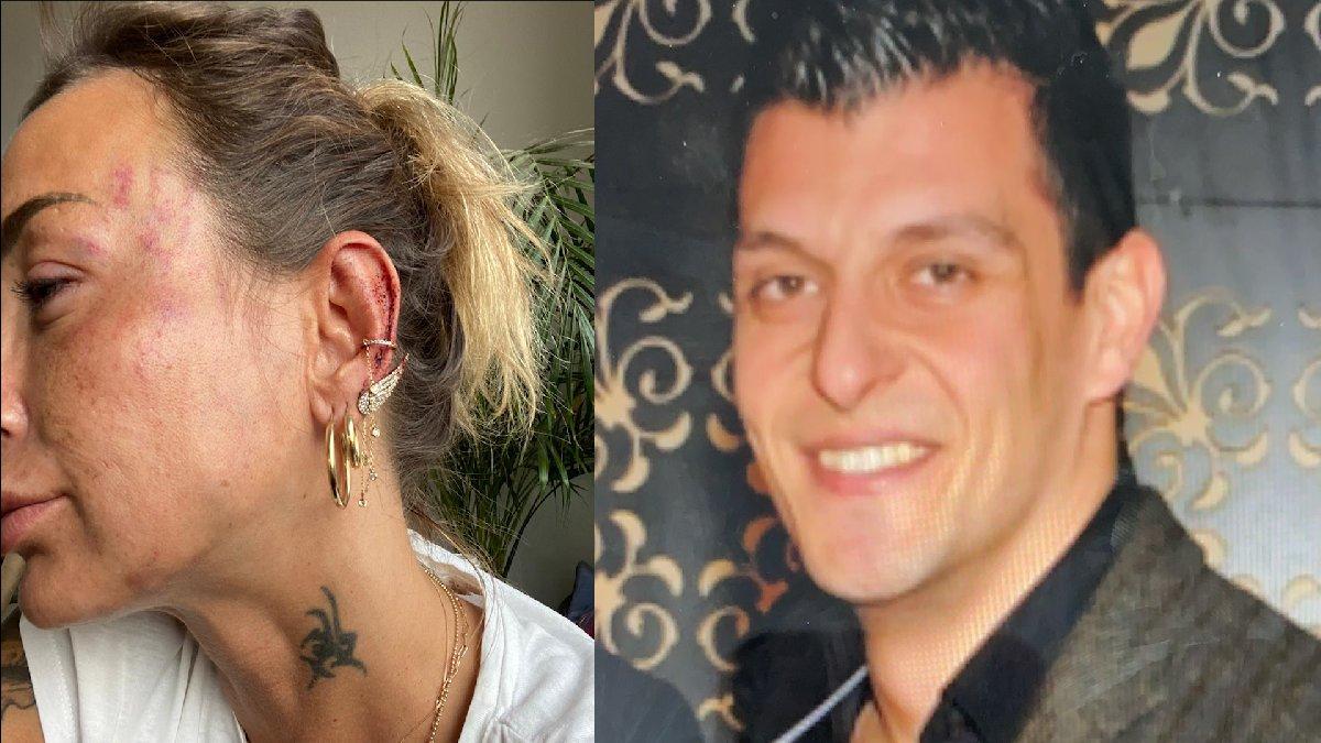 Eski sevgilisini döven sanığa 'iyi hal' indirimi