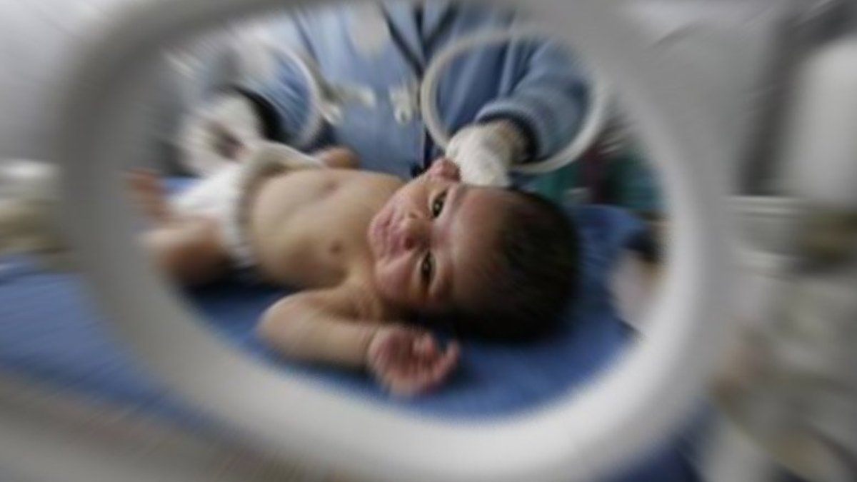 Bebeklere yer fıstığı verilmesi yer fıstığı alerjisi riskini yüzde 77 düşürebilir