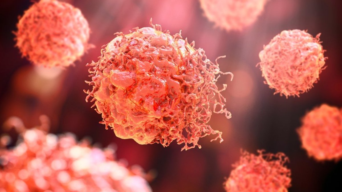 Kanserin yayılmasında etkili olan hücreler tespit edildi