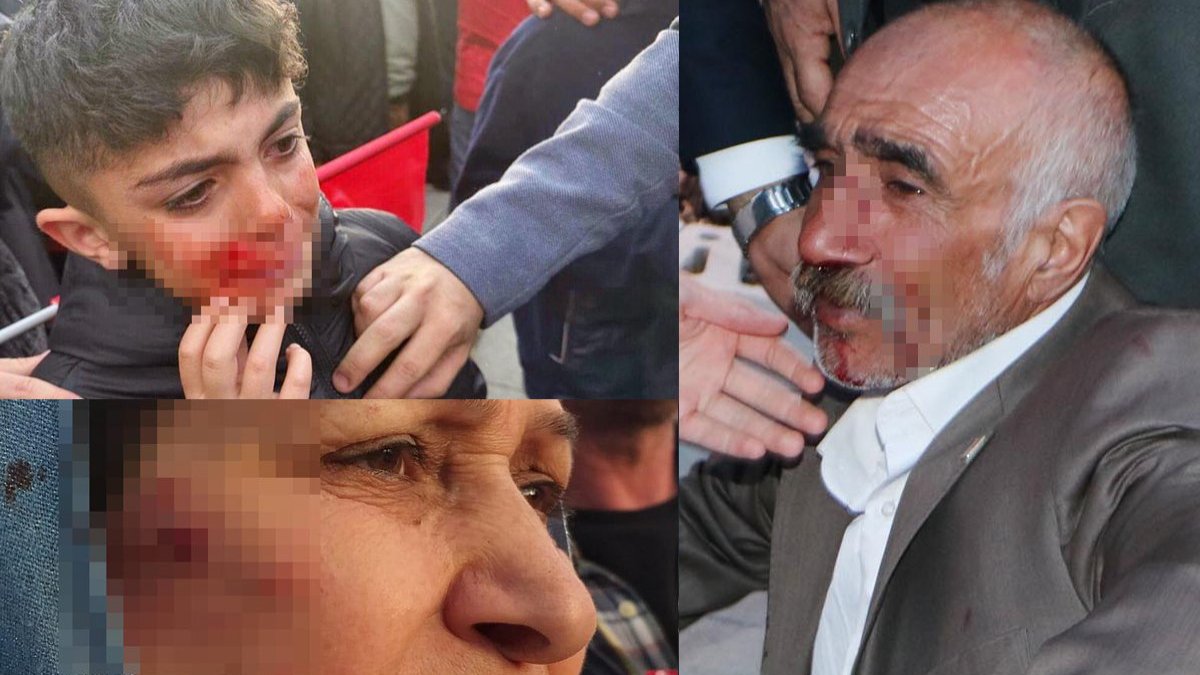 İmamoğlu'nun mitingine yönelik saldırıda yaralanan 17 kişi taburcu edildi