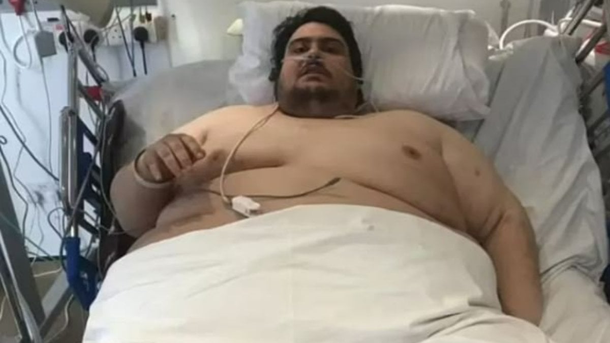 Ülkedeki en şişman adam: Günde tam 10 bin kalori alıyor