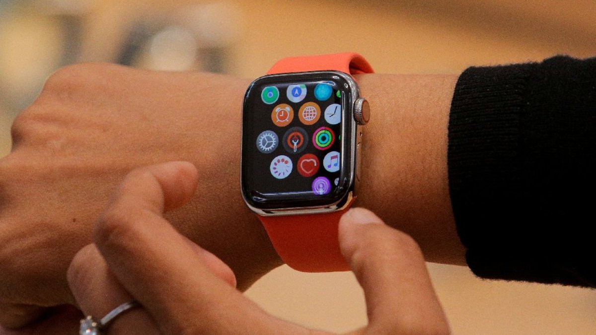 Apple Watch kullanıcıları öfkeli... Şikayetler bitmiyor