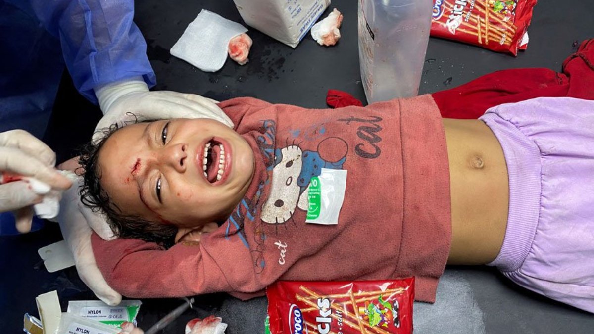 Gazze'de anestezisiz ameliyatlar... 'Ya bu acıyı çekecekler ya da ölecekler'