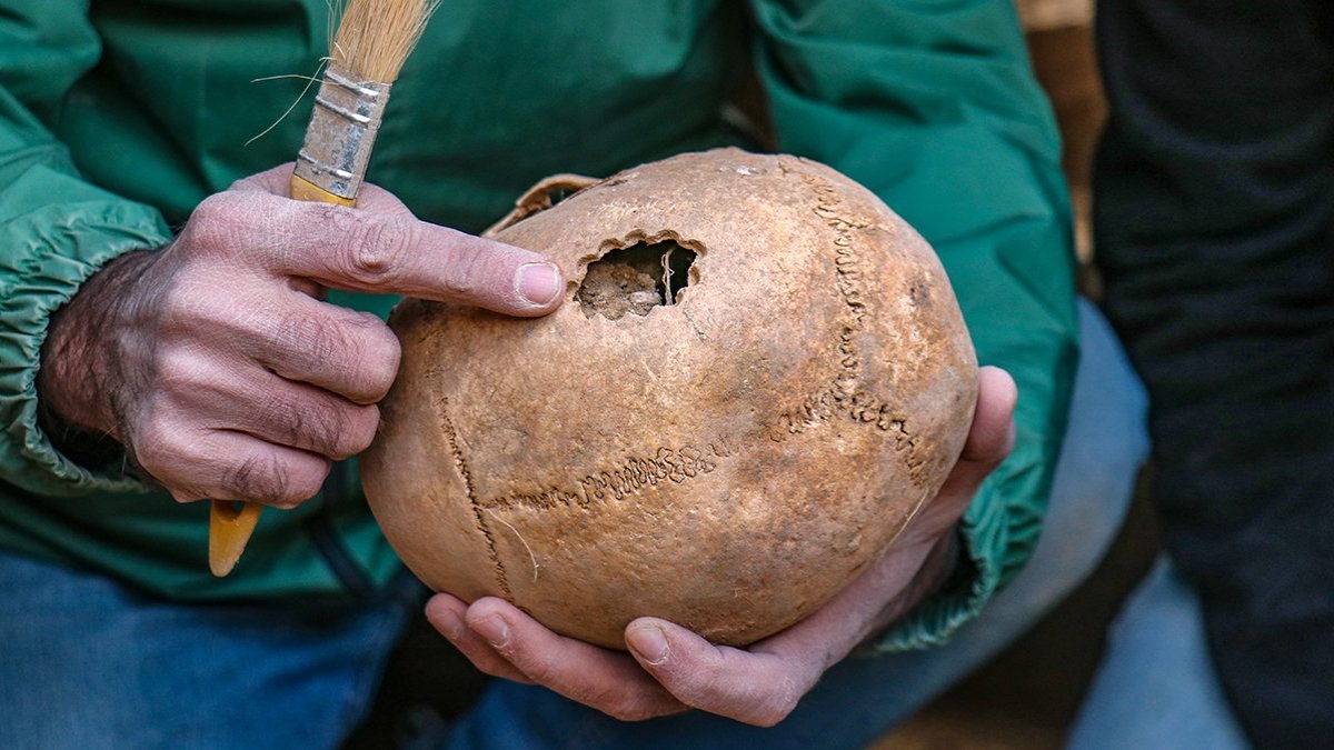 Van'da 3 bin 200 yıl öncesine ait beyin ameliyatı izine rastlandı